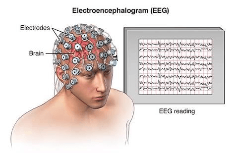 Sleep Deprivation Gamma Power Meta-analysis