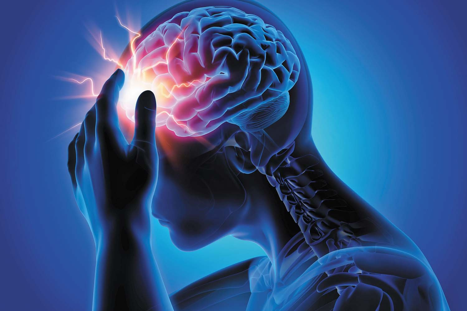 TBI Voxel-based Morphometry Review